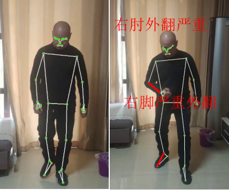 中风康复训练助手——智能步态训练系统